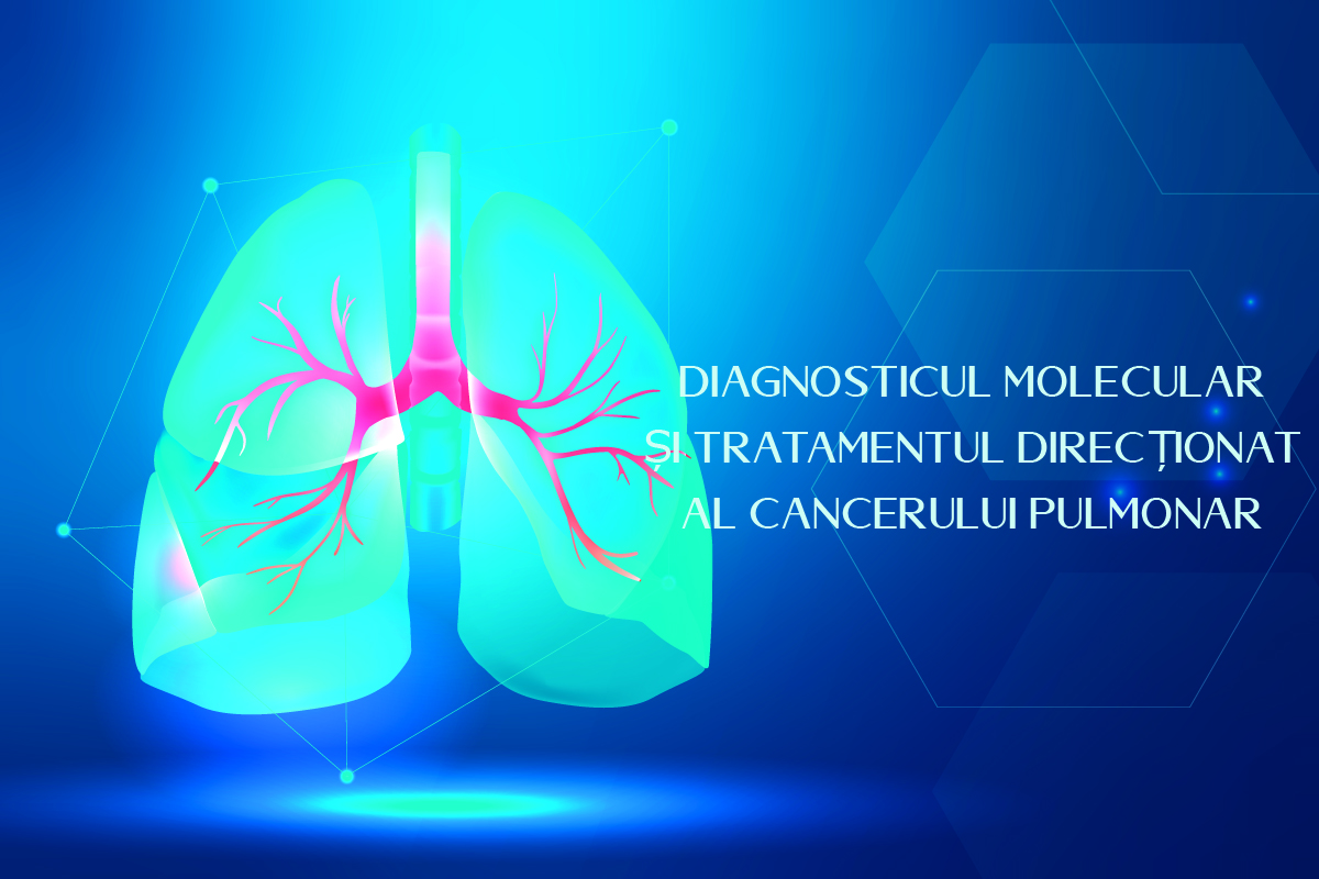 Diagnosticul molecular și tratamentul direcționat al cancerului pulmonar